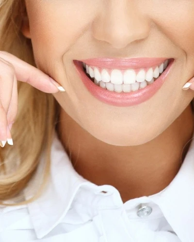 Estética Dental