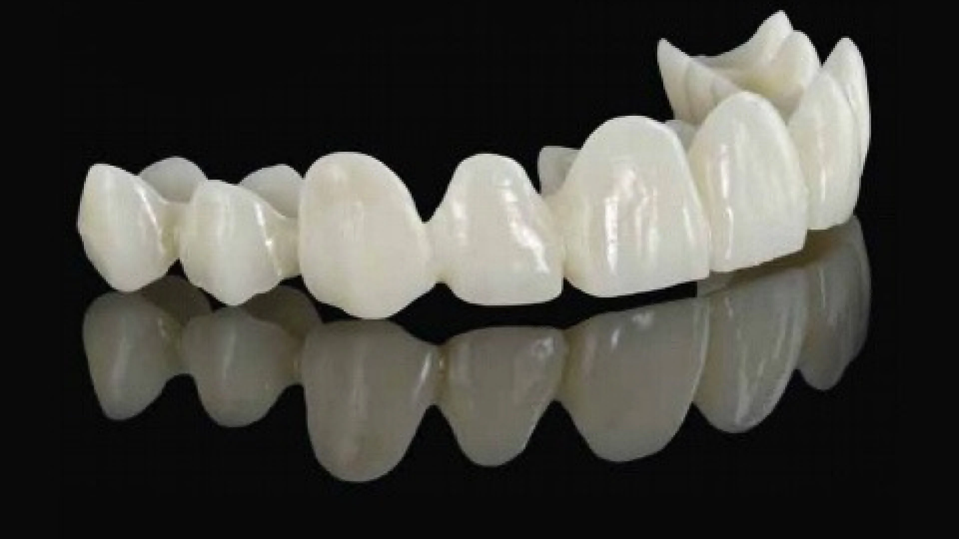 Fixed Prosthodontics